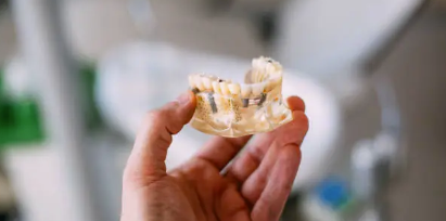dental implants Adelaide